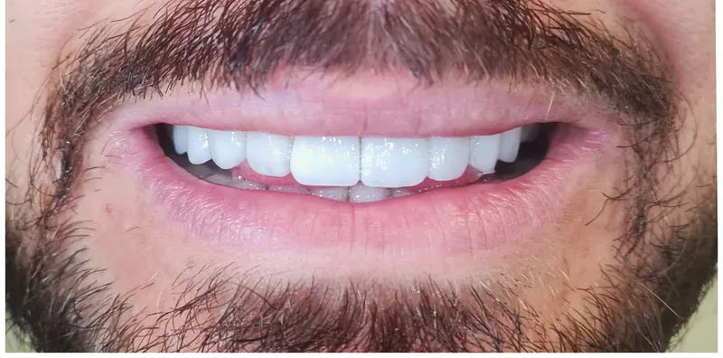 A clean, bright smile