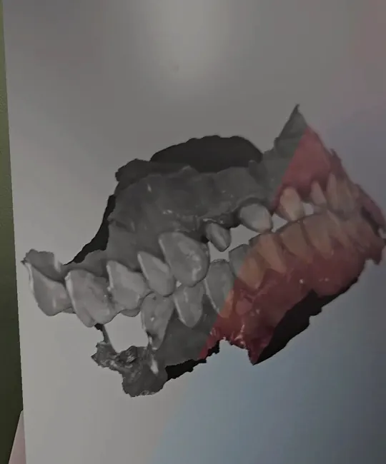 A 3D scan of a patient's teeth on the clinic screen